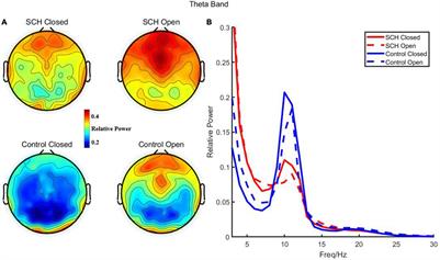 Correlation Between Resting Theta Power and Cognitive Performance in Patients With Schizophrenia